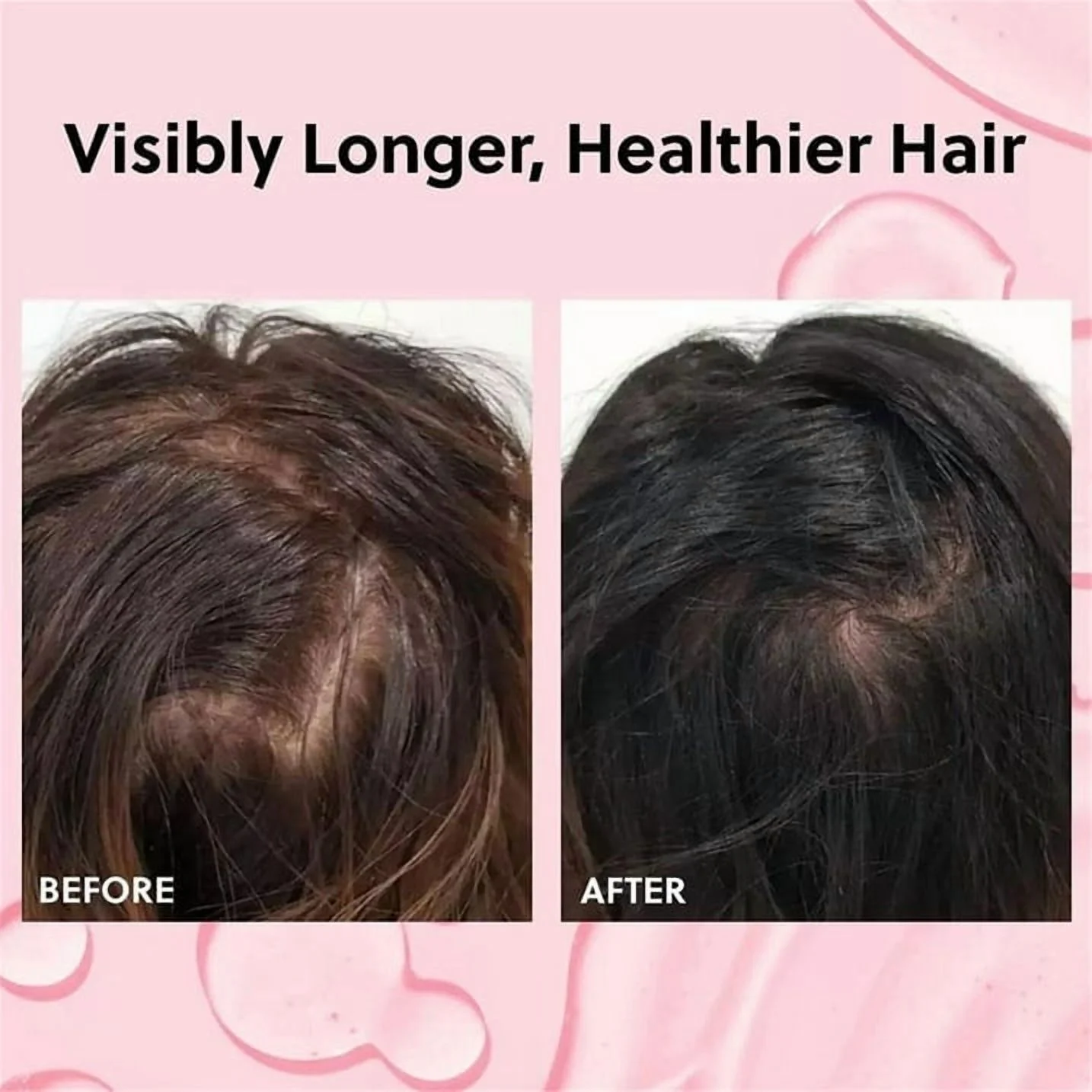 Hair Growth Serum for Women- Results in 4 Weeks- Hormone Free Hair Regrowth Treatment - For Thinning Hair Loss - Fast Absorbing Non-Greasy Scalp Spray 50ml